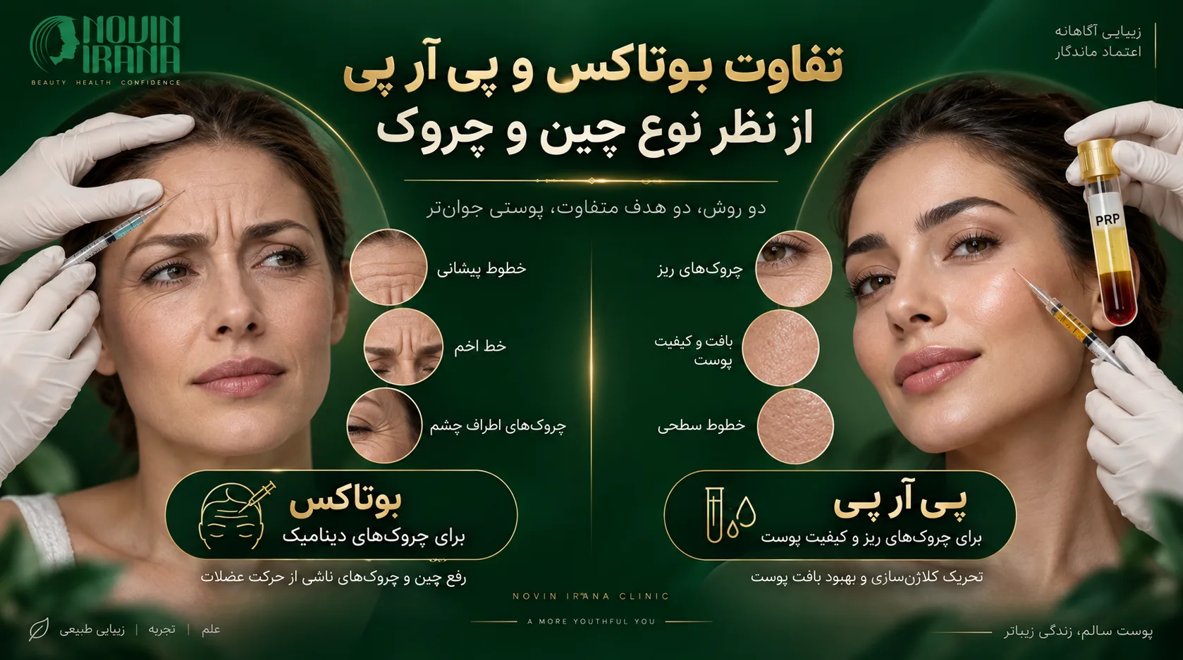 تفاوت بوتاکس و پی آر پی از نظر نوع چین و چروک